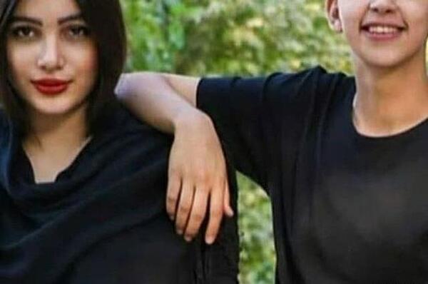 عکس فریال قبل از عمل بینی