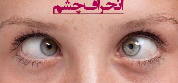عکس چشم لوچی