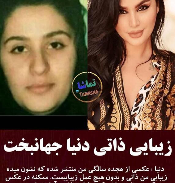 عکس زشت دنیا جهانبخت