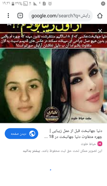 عکس زشت دنیا جهانبخت