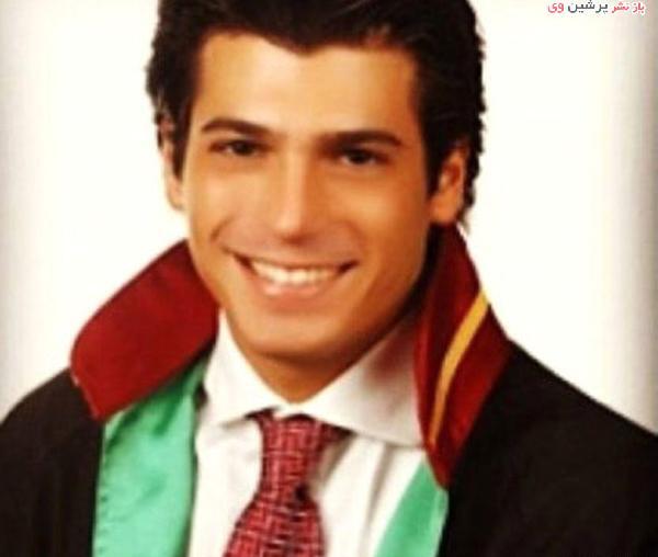 عکس جان یامان قبل از عمل