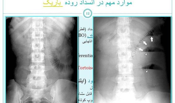 عکس ساده شکم