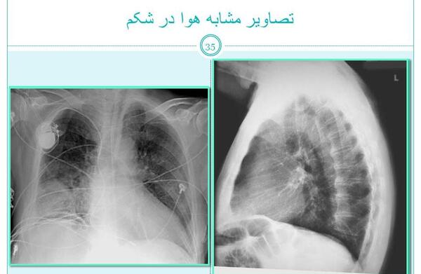 عکس ساده شکم