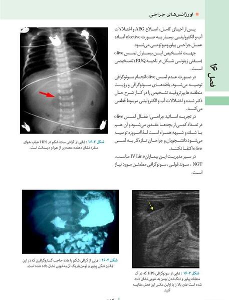 عکس ساده شکم