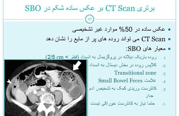عکس ساده شکم