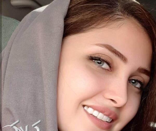 عکس ضحی نی نی سایت