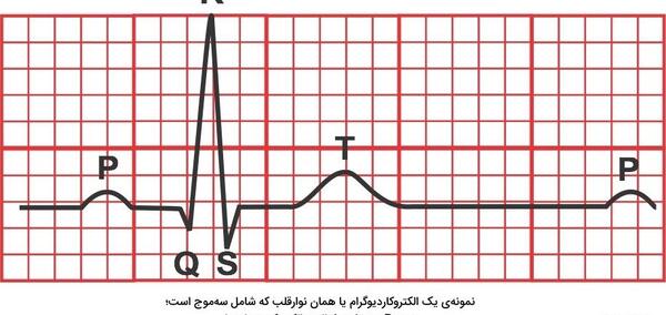 عکس چرخه ضربان قلب