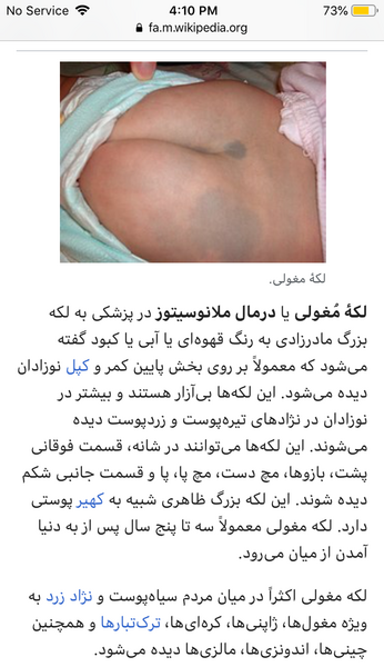 عکس کبودی پشت کتف