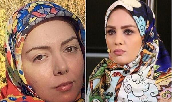 عکس بارداری ژیلا صادقی