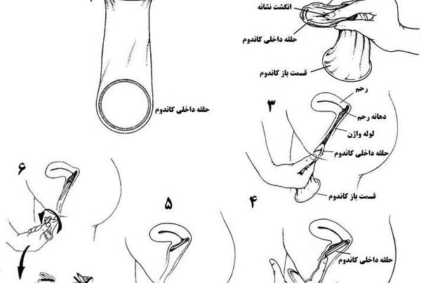 عکس کاندوم مردانه و نحوه استفاده