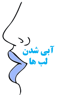 عکس کبودی لب نوزاد