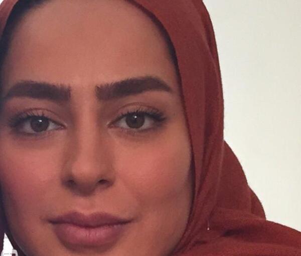 عکس سمانه پاکدل قبل عمل