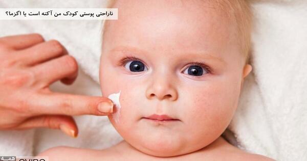 عکس نوزاد چشم ریز