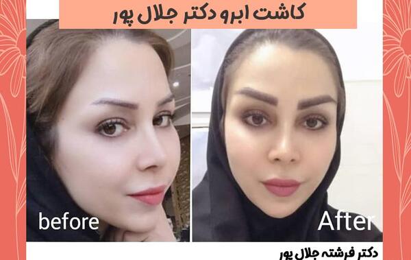 عکس جلال پور