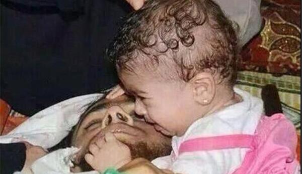 عکس بچه زخمی