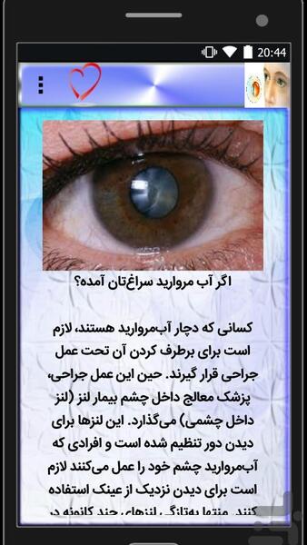 عکس پیر چشمی