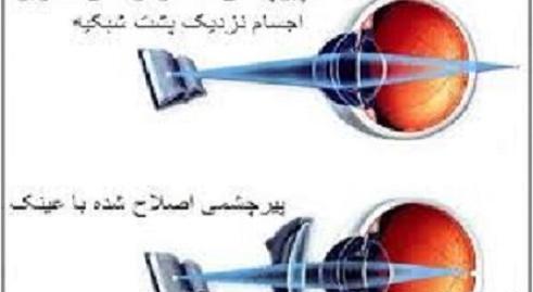 عکس پیر چشمی