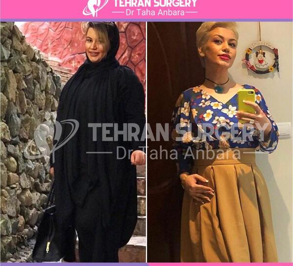 عکس طاها قبل از عمل
