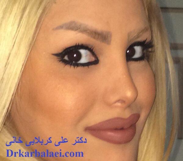 عکس دکتر کبود خانی
