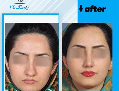 عکس دکتر کبود خانی