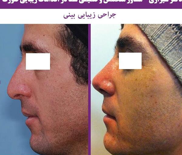عکس دکتر کبود خانی
