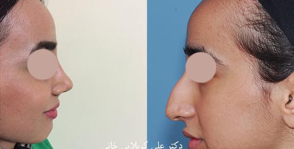 عکس دکتر کبود خانی
