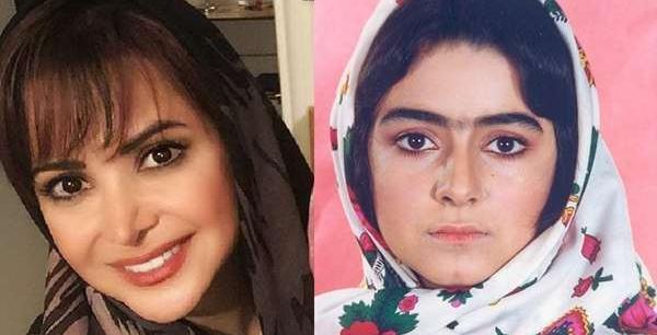 عکس سحر ولدبیگی قبل از عمل