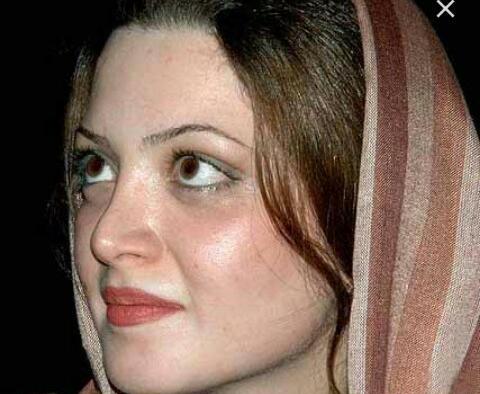 عکس سحر ولدبیگی قبل از عمل
