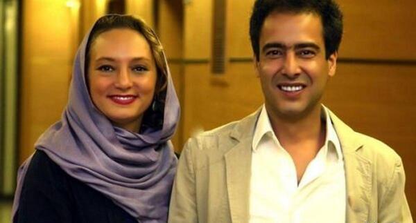 عکس سحر ولدبیگی قبل از عمل