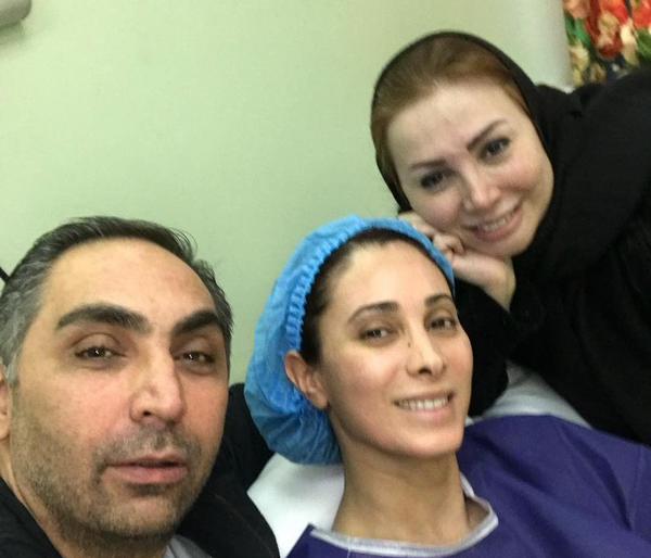 عکس سحر ولدبیگی قبل از عمل