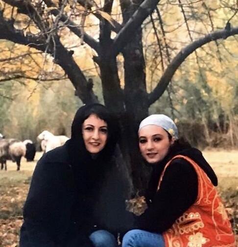 عکس سحر ولدبیگی قبل از عمل