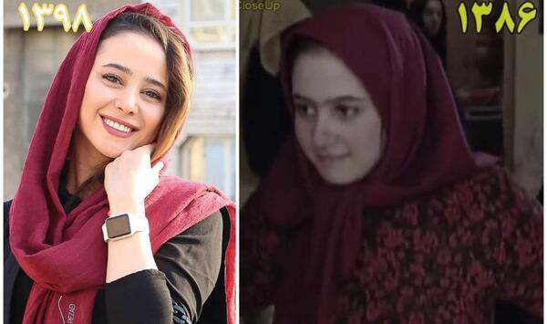 عکس سحر ولدبیگی قبل از عمل