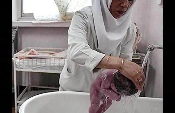عکس نوزاد سه کیلویی