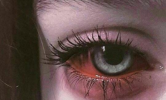 عکس چشم پر از خون