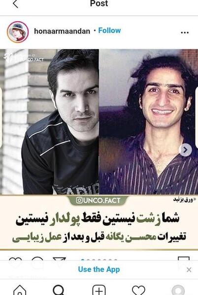عکس قبل عمل محسن یگانه