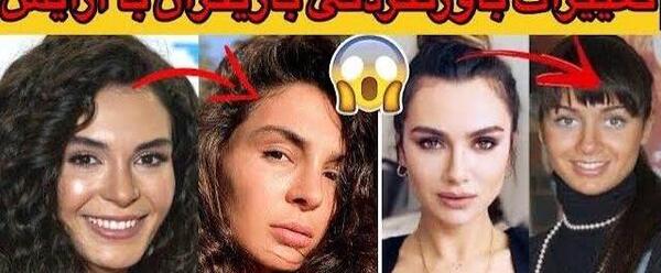 عکسهای ییلدیز بدون آرایش