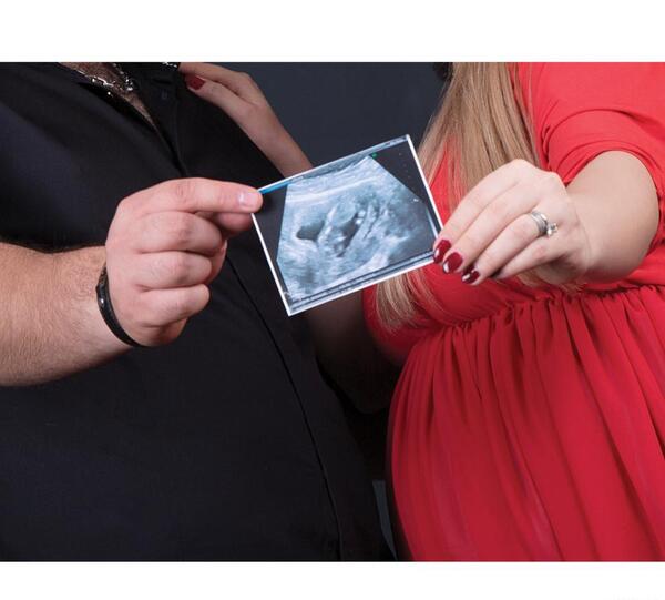 عکس باردار طبیعی