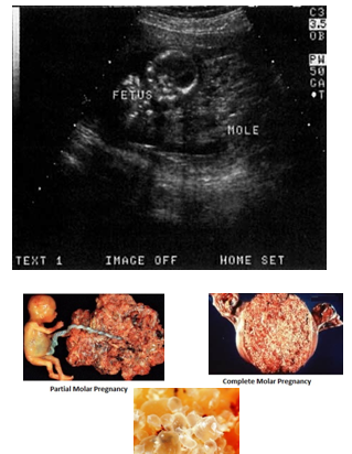 عکس بچه خوره در رحم