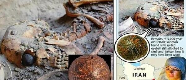 عکس چشم مصنوعی در شهر سوخته