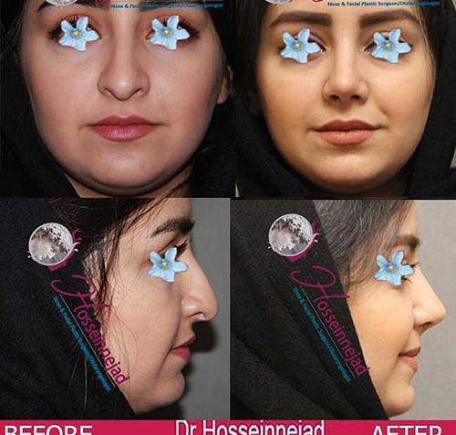 عکس دکتر بهنام غفاری جراح بینی در ساری