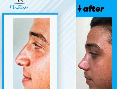 عکس دکتر بهنام غفاری جراح بینی در ساری