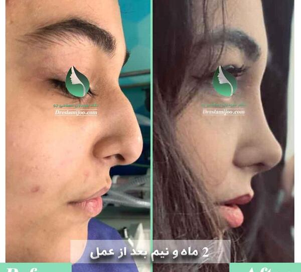 عکس دکتر بهنام غفاری جراح بینی در ساری