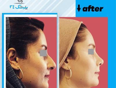 عکس دکتر بهنام غفاری جراح بینی در ساری