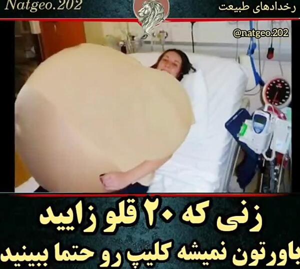 عکس بچه صد قلو