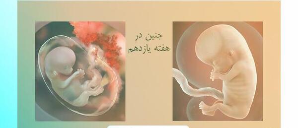 عکس جنین پسر یازده هفته