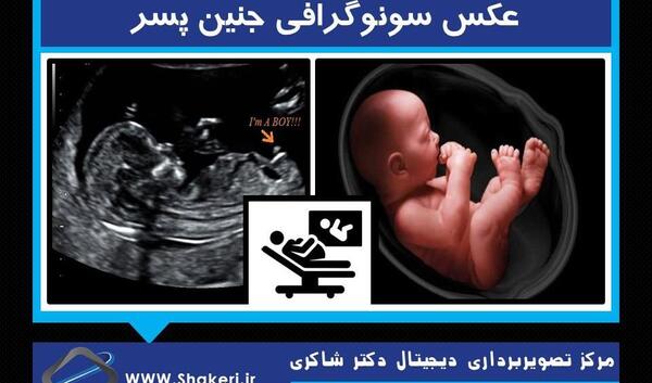 عکس جنین پسر یازده هفته