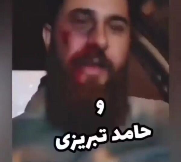عکس حامد تبریزی و برادرش