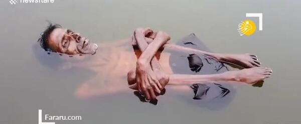 عکس مرد فلج