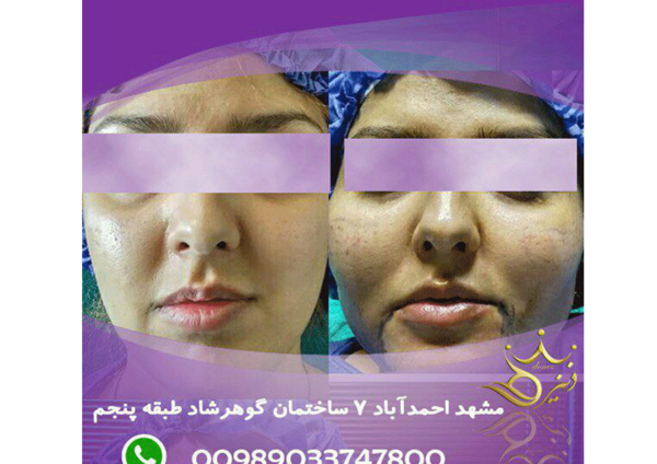 عکس زیبای دنیز