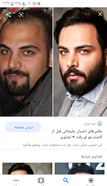 عکس احسان قبل از عمل